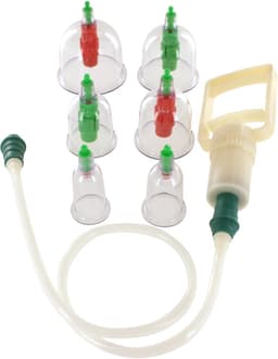 Vacuum Cupping Set — thumbnail 1