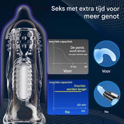 Vitdipy - Cockring - Vibrerend - G-Spot - Penis Sleeve - Waterdicht - Sex Toys voor Koppels - Perineum Stimulatie - Zwart — thumbnail 3