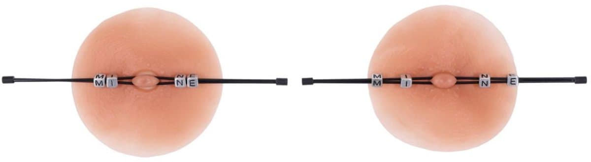 Sportsheets - Edge Pinching Rods - Zwart — afbeelding 1
